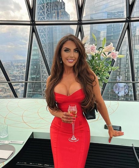 Misskayleighrosedematos