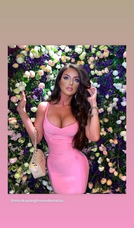 Misskayleighrosedematos