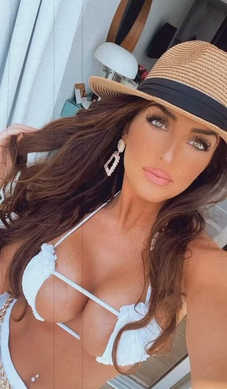 Misskayleighrosedematos