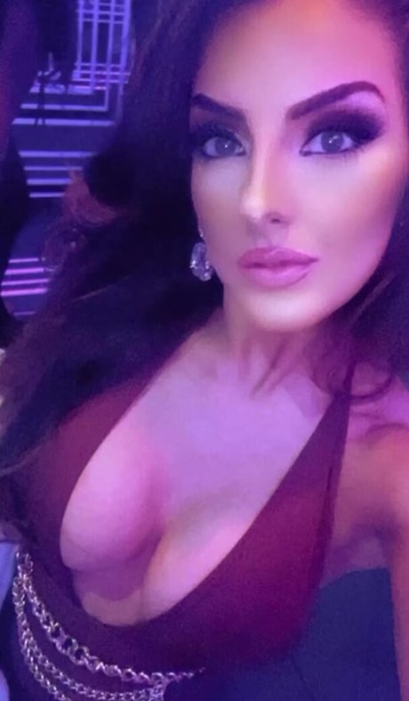 Misskayleighrosedematos