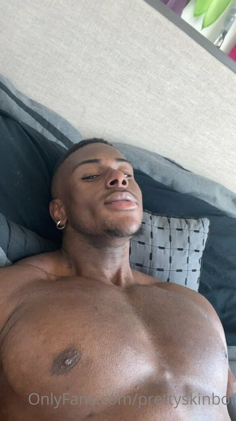 Prettyskinboi